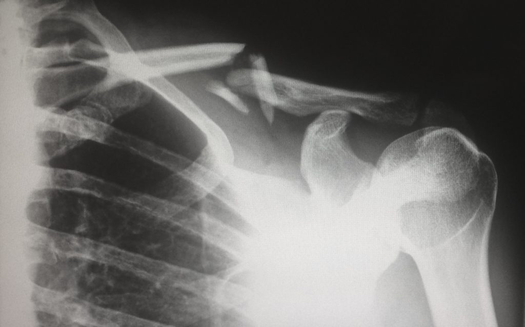 X ray devices used in medical industry