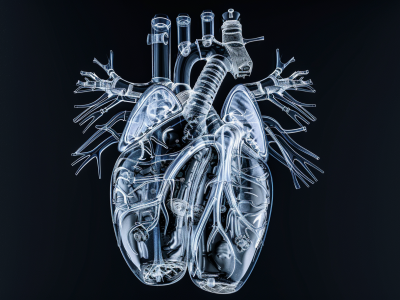 medical-devices-and-implants